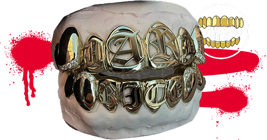 Zlatá grilzka od Yo Grillz